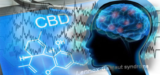 Sindrome di Lennox-Gastaut e CBD Cannabidiolo