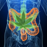 Carcinogenesi del Colon inibita dal CBD Cannabidiolo