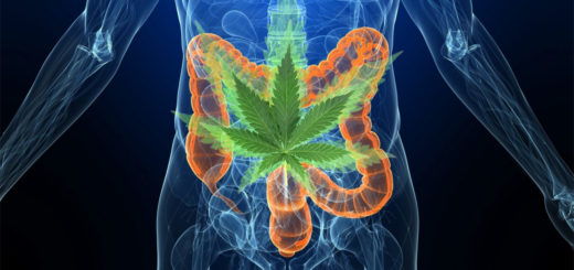 Carcinogenesi del Colon inibita dal CBD Cannabidiolo