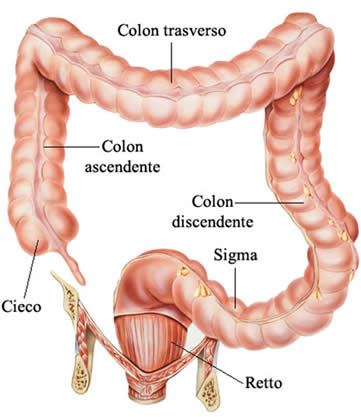 Carcinogenesi del Colon inibita dal CBD Cannabidiolo